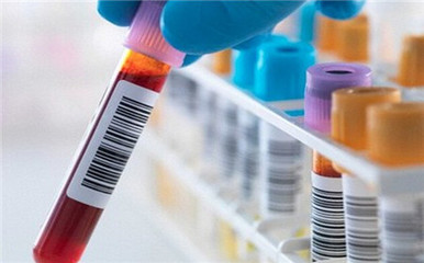 艾滋病是如何感染的？